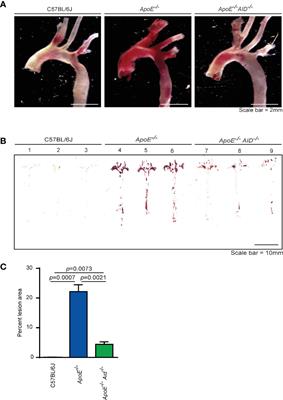 Auto-Antibody Production During Experimental Atherosclerosis in ApoE-/- Mice